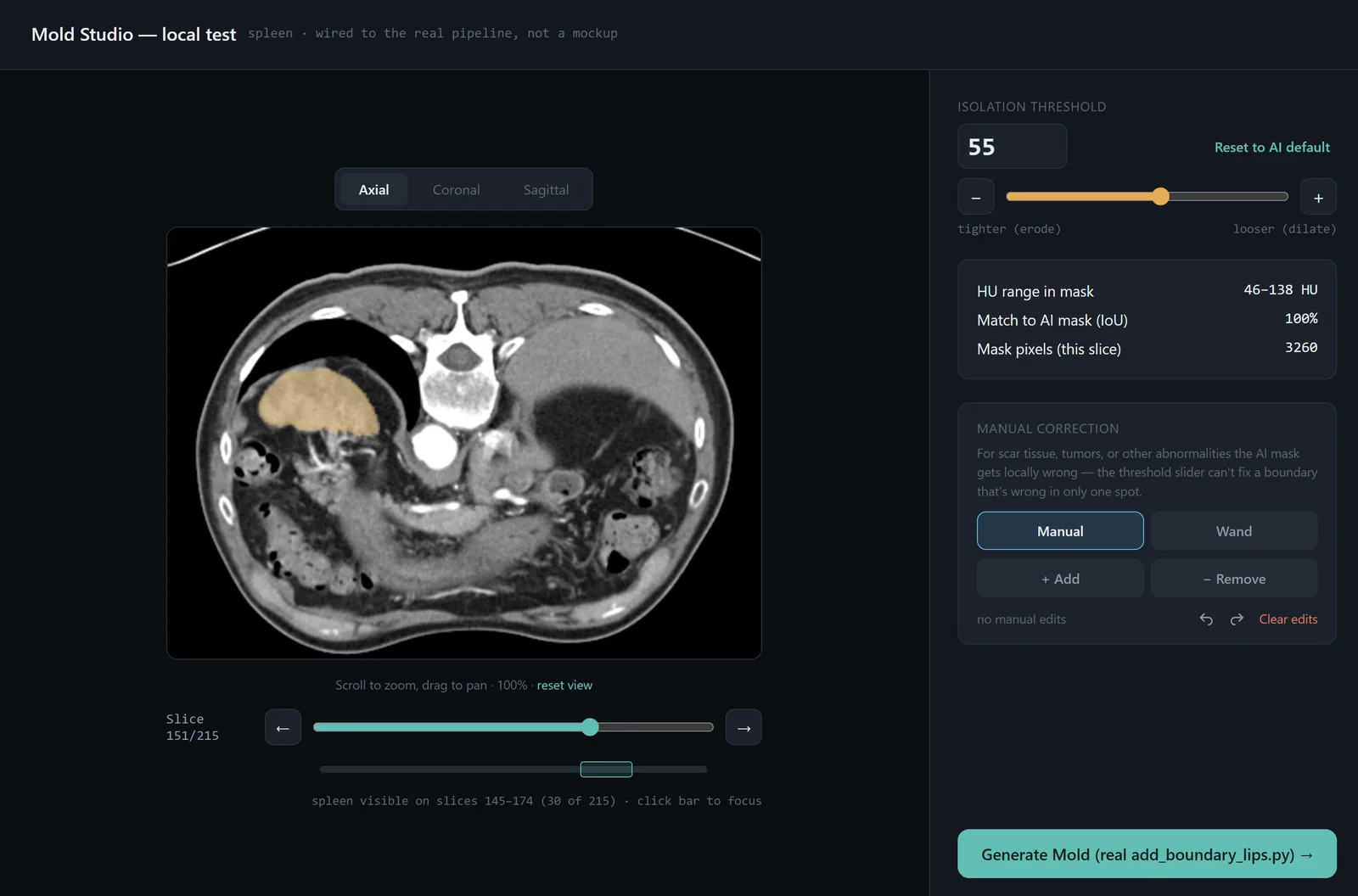 Mold Studio interface: a CT slice with the segmented spleen highlighted, isolation-threshold and manual-correction controls beside it