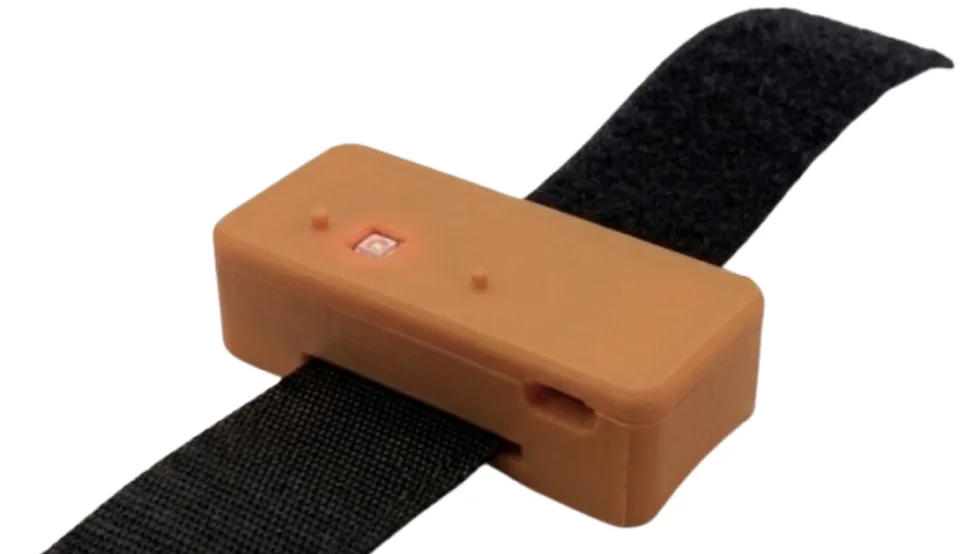 Wrist-worn pulse-wave-velocity monitor prototype on a velcro strap